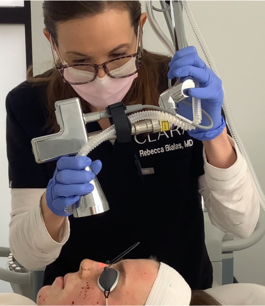 Qu'est-ce que le resurfaçage au laser, informations présentées par les meilleurs dermatologues de Cary, Clara Dermatology.